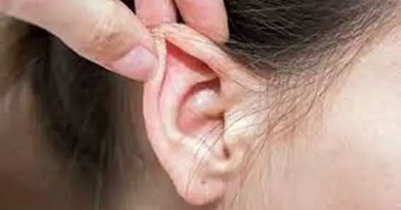 Ear Splinting For Natural Ear Adjustment