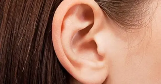 how to pin back ears naturally